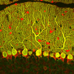 Neurons in the cerebellum